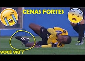 Árbitro sufre terrible fractura en pleno partido